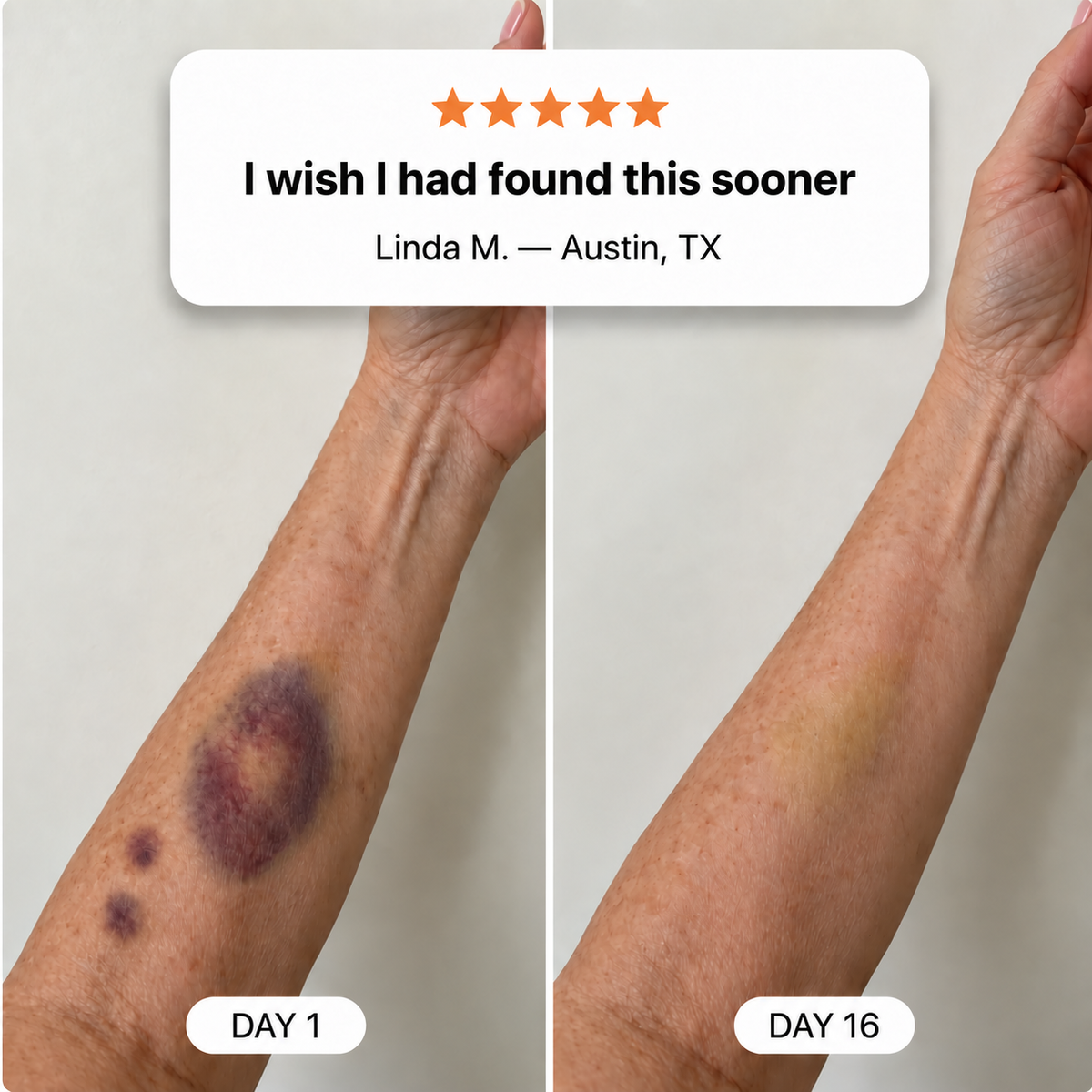 Oleir Bruise Moisturizing Cream