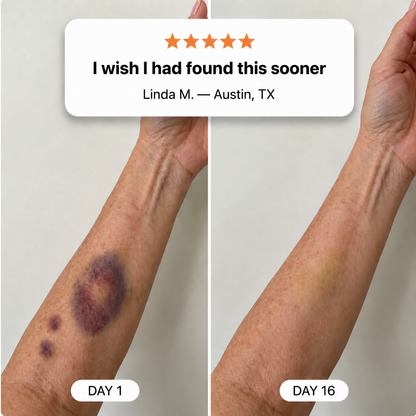 Oleir Bruise Moisturizing Cream